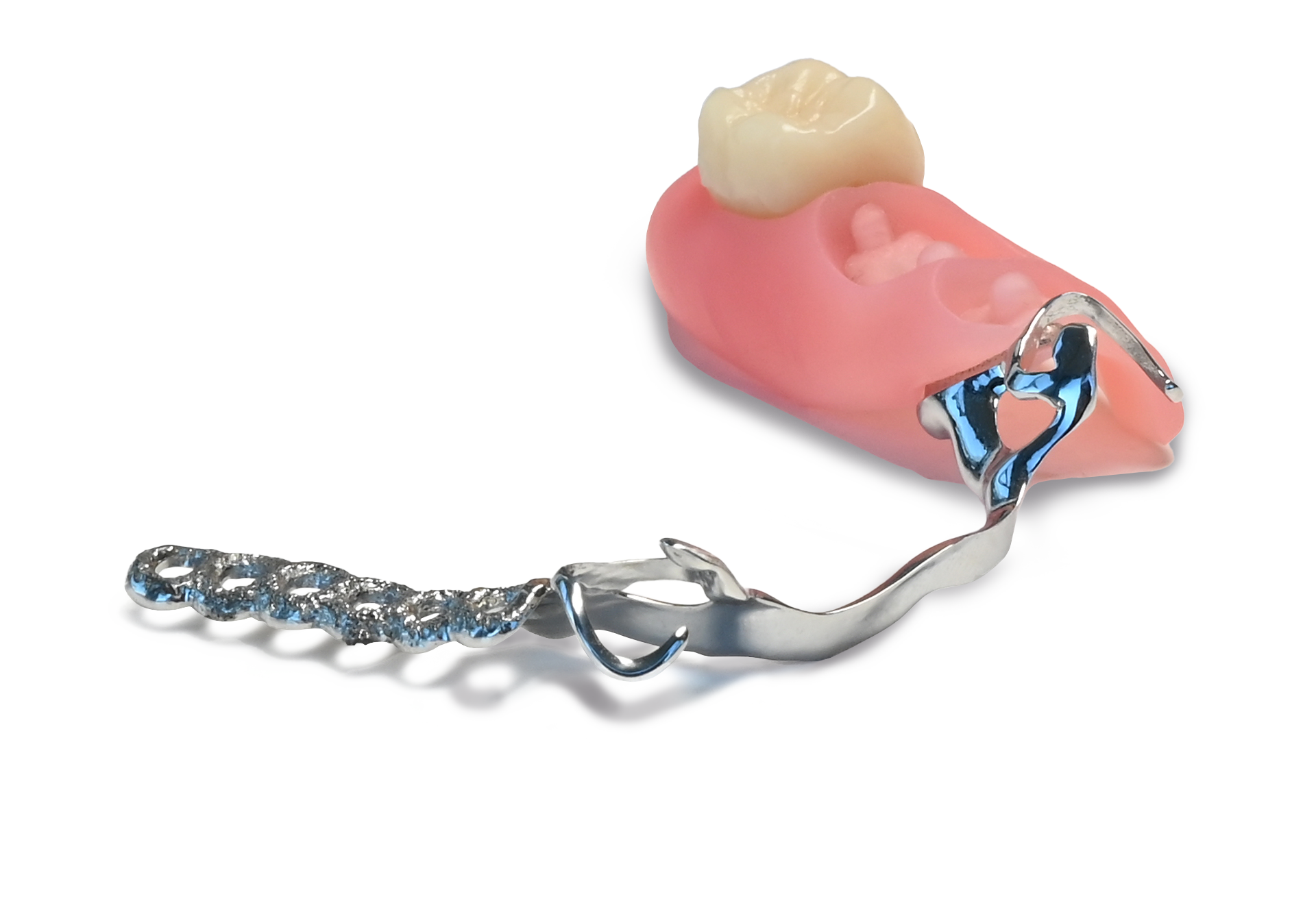 ModularDenture by CADdent® ModularDenture by CADdent®