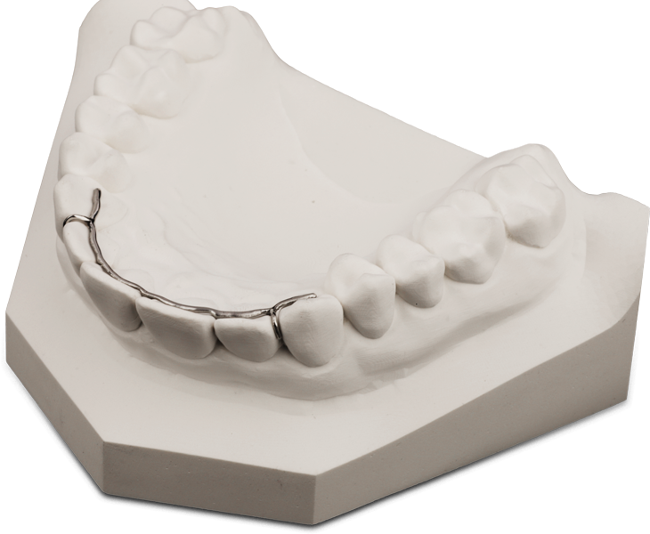 Retainer Kobalt-Chrom und Titan gelasert CadDent