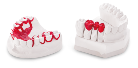 Casting 3D dental technology - manufactured in 3D printing process