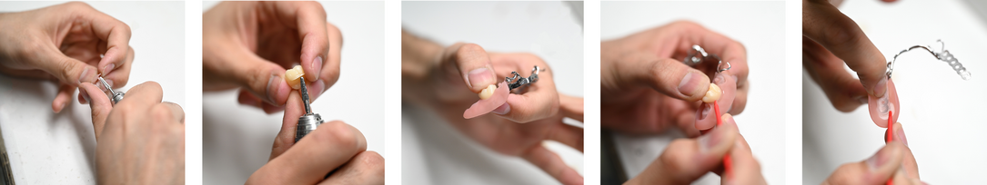 ModularDenture by CADdent® ModularDenture by CADdent®